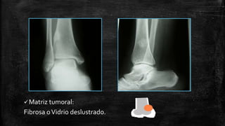 Per Rio Classification Comprehensive Overview of Bone Tumors: Classification, Imaging, and ...