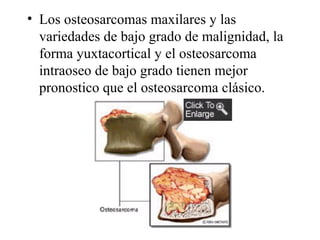 • Los osteosarcomas maxilares y las
  variedades de bajo grado de malignidad, la
  forma yuxtacortical y el osteosarcoma
  intraoseo de bajo grado tienen mejor
  pronostico que el osteosarcoma clásico.
 