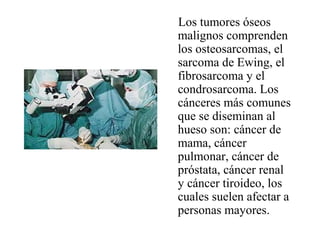 Los tumores óseos
malignos comprenden
los osteosarcomas, el
sarcoma de Ewing, el
fibrosarcoma y el
condrosarcoma. Los
cánceres más comunes
que se diseminan al
hueso son: cáncer de
mama, cáncer
pulmonar, cáncer de
próstata, cáncer renal
y cáncer tiroideo, los
cuales suelen afectar a
personas mayores.
 