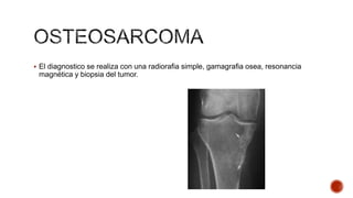  El diagnostico se realiza con una radiorafia simple, gamagrafia osea, resonancia

magnética y biopsia del tumor.

 