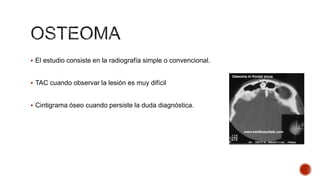  El estudio consiste en la radiografía simple o convencional.

 TAC cuando observar la lesión es muy difícil

 Cintigrama óseo cuando persiste la duda diagnóstica.

 