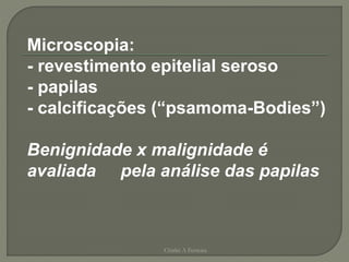 Microscopia:
- revestimento epitelial seroso
- papilas
- calcificações (“psamoma-Bodies”)
Benignidade x malignidade é
avaliada pela análise das papilas
Chirlei A Ferreira
 