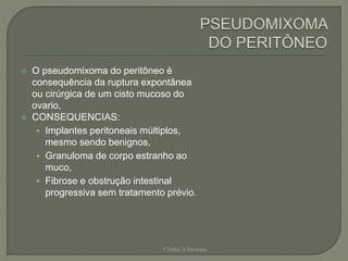  O pseudomixoma do peritôneo é
consequência da ruptura expontânea
ou cirúrgica de um cisto mucoso do
ovario,
 CONSEQUENCIAS:
• Implantes peritoneais múltiplos,
mesmo sendo benignos,
• Granuloma de corpo estranho ao
muco,
• Fibrose e obstrução intestinal
progressiva sem tratamento prévio.
Chirlei A Ferreira
 