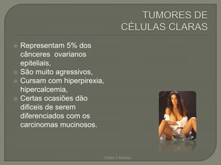  Representam 5% dos
cânceres ovarianos
epiteliais,
 São muito agressivos,
 Cursam com hiperpirexia,
hipercalcemia,
 Certas ocasiões dão
dificeis de serem
diferenciados com os
carcinomas mucinosos.
Chirlei A Ferreira
 