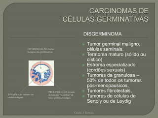 DISGERMINOMA
 Tumor germinal maligno,
células seminais,
 Teratoma maturo (sólido ou
cístico)
 Estroma especializado
(cordões sexuais)
 Tumores da granulosa –
50% de todos os tumores
pós-menopausicos,
 Tumores fibrotectais,
 Tumores de células de
Sertoly ou de Leydig
Chirlei A Ferreira
DIFERENCIAÇÃO: lesões
benignas não proliferativas
INVASÃO: do estroma em
células malignas
PROLIFERAÇÃO: invasão
de tumores “boderline” de
baixo potencial maligno
 