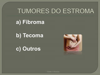 a) Fibroma
b) Tecoma
c) Outros
Chirlei A Ferreira
 