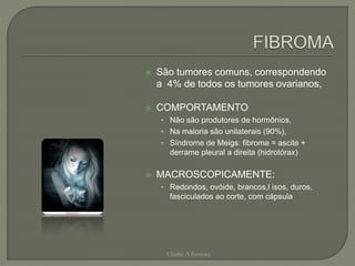  São tumores comuns, correspondendo
a 4% de todos os tumores ovarianos,
 COMPORTAMENTO
• Não são produtores de hormônios,
• Na maioria são unilaterais (90%),
• Síndrome de Meigs: fibroma = ascite +
derrame pleural a direita (hidrotórax)
 MACROSCOPICAMENTE:
• Redondos, ovóide, brancos,l isos, duros,
fasciculados ao corte, com cápsula
Chirlei A Ferreira
 