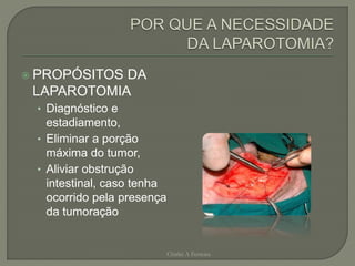  PROPÓSITOS DA
LAPAROTOMIA
• Diagnóstico e
estadiamento,
• Eliminar a porção
máxima do tumor,
• Aliviar obstrução
intestinal, caso tenha
ocorrido pela presença
da tumoração
Chirlei A Ferreira
 