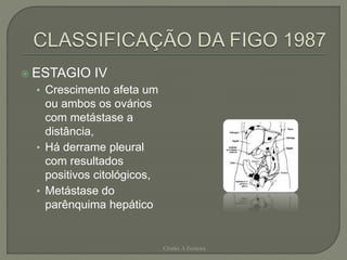  ESTAGIO IV
• Crescimento afeta um
ou ambos os ovários
com metástase a
distância,
• Há derrame pleural
com resultados
positivos citológicos,
• Metástase do
parênquima hepático
Chirlei A Ferreira
 
