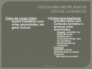 Cisto de corpo lúteo:
centro hemático com
orlas amareladas, em
geral únicos
b)Cistos teca-luteínicos:
grandes cistos com
conteúdo hemático e
grossas orlas
amareladas.
Causas: gravidez, no
curso de mola
hidatiforme e
coriocarcinomas, uso
de clomifene
(estimulantes da
ovulação)
Conduta:
cessada a causa
determinante os cistos
involuem.
Não tocar no ovário!
Chirlei A Ferreira
 