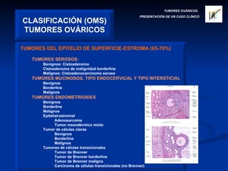 CLASIFICACIÓN (OMS) TUMORES OVÁRICOS TUMORES OVÁRICOS.  PRESENTACIÓN DE UN CASO CLÍNICO TUMORES DEL EPITELIO DE SUPERFICIE-ESTROMA (65-70%)   TUMORES SEROSOS: Benignos: Cistoadenoma Cistoadenoma de malignidad borderline Malignos: Cistoadenocarcinoma seroso TUMORES MUCINOSOS, TIPO ENDOCERVICAL Y TIPO INTERSTICIAL Benignos Borderline Malignos TUMORES ENDOMETRIOIDES Benignos Borderline Malignos Epitelial-estromal Adenosarcoma Tumor mesodérmico mixto Tumor de células claras Benignos Borderline Malignos Tumores de células transicionales Tumor de Brenner Tumor de Brenner borderline Tumor de Brenner maligno Carcinoma de células transicionales (no Brenner) 