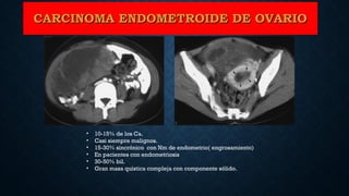 CARCINOMA ENDOMETROIDE DE OVARIOCARCINOMA ENDOMETROIDE DE OVARIO
• 10-15% de los Ca.
• Casi siempre malignos.
• 15-30% sincrónico con Nm de endometrio( engrosamiento)
• En pacientes con endometriosis
• 30-50% bil.
• Gran masa quística compleja con componente sólido.
 