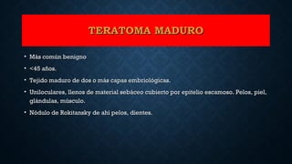 TERATOMA MADUROTERATOMA MADURO
• Más común benignoMás común benigno
• <45 años.<45 años.
• Tejido maduro de dos o más capas embriológicas.Tejido maduro de dos o más capas embriológicas.
• Uniloculares, llenos de material sebáceo cubierto por epitelio escamoso. Pelos, piel,Uniloculares, llenos de material sebáceo cubierto por epitelio escamoso. Pelos, piel,
glándulas, músculo.glándulas, músculo.
• Nódulo de Rokitansky de ahí pelos, dientes.Nódulo de Rokitansky de ahí pelos, dientes.
 