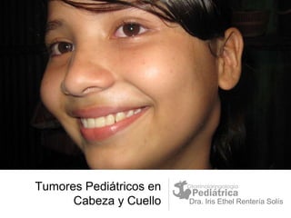 Tumores Pediátricos en
Cabeza y Cuello Dra. Iris Ethel Rentería Solís
 