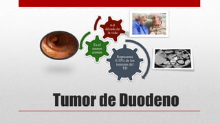 Tumor de Duodeno
Representa
0.35% de los
tumores del
TD
Es el
menos
común
6-8
década de
la vida
 