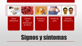 Signos y síntomas
Dolor
abdominal
Anemia
por
deficiencia
de hierro
Nauseas y
vómitos
Perdía de
peso
Ictericia
obstructiva
 