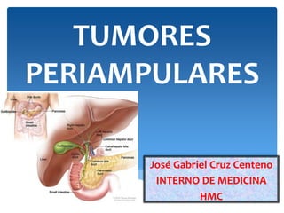TUMORES
PERIAMPULARES
José Gabriel Cruz Centeno
INTERNO DE MEDICINA
HMC
 