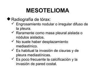 MESOTELIOMA
Radiografía de tórax:
 Engrosamiento nodular o irregular difuso de
la pleura.
 Raramente como masa pleural aislada o
nódulos aislados.
 No suele haber desplazamiento
mediastínico.
 Es habitual la invasión de cisuras y de
pleura mediastínicas.
 Es poco frecuente la calcificación y la
invasión de pared costal.
 