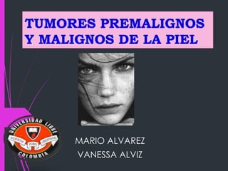 MARIO ALVAREZ
VANESSA ALVIZ
 
