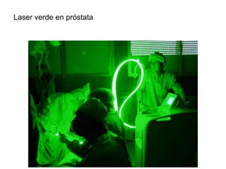 Laser verde en próstata
 