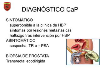 DIAGNÓSTICO CaP
SINTOMÁTICO
superponible a la clínica de HBP
síntomas por lesiones metastásicas
hallazgo tras intervención por HBP
ASINTOMÁTICO
sospecha: TR o ↑ PSA
BIOPSIA DE PRÓSTATA
Transrectal ecodirigida
 