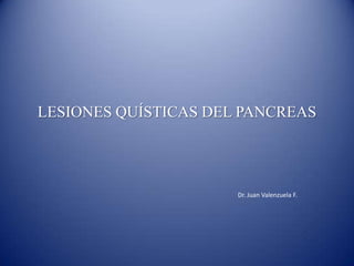 LESIONES QUÍSTICAS DEL PANCREAS Dr. Juan Valenzuela F. 