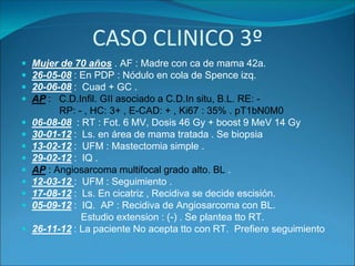 Tumores radioinducidos | PPSX