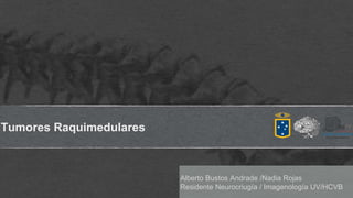 Tumores Raquimedulares
Alberto Bustos Andrade /Nadia Rojas
Residente Neurocriugía / Imagenología UV/HCVB
 