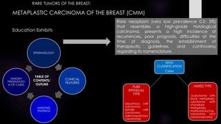 METAPLASTIC CARCINOMA OF THE BREAST (CMM)
Education Exhibits
TABLE OF
CONTENTS/
OUTLINE
EPIDEMIOLOGY
CLINICAL
FEATURES
IMAGING
FINDINGS
IMAGEN
PRESENTATIO
N OF CASES
Rare neoplasm (very low prevalence 0.2- 5%)
that resembles a high-grade histological
carcinoma, presents a high incidence of
recurrences, poor prognosis, difficulties at the
time of diagnosis, the establishment of
therapeutic guidelines, and controversy
regarding its nomenclature.
WHO
CLASSIFICATION
CMM
PURE
EPITHELIAL
TYPE
(squamous cell
carcinoma,
spindle cell
carcinoma,
adenosquamous
carcinoma)
MIXED TYPE
(carcinoma with
bone metaplasia,
carcinoma with
chondroid
metaplasia,
matrix-producing
carcinoma and
carcinosarcoma
RARE TUMORS OF THE BREAST:
 