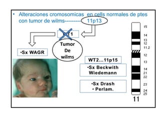 • Alteraciones cromosomicas en cells normales de ptes
  con tumor de wilms--------- 11p13



                  Tumor
                    De
                  wilms
 