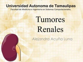 Tumores
Renales
Alejandra Acuña Luna
Universidad Autonoma de Tamaulipas
Facultad de Medicina e Ingenieria en Sistemas Computacionales.
 