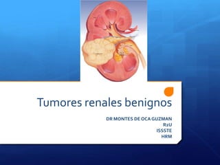 Tumores renales benignos
DR MONTES DE OCA GUZMAN
R2U
ISSSTE
HRM
 