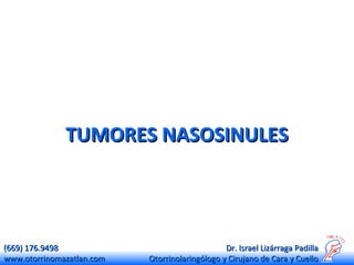 TUMORES NASOSINULES

(669) 176.9498
www.otorrinomazatlan.com

Dr. Israel Lizárraga Padilla
Otorrinolaringólogo y Cirujano de Cara y Cuello

 
