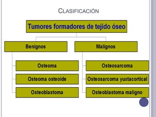 CLASIFICACIÓN
 