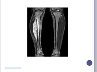 SRFEYNMAN.BLOGSPOT.COM
 