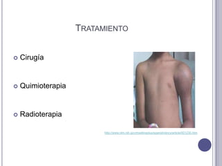 TRATAMIENTO


   Cirugía


   Quimioterapia


   Radioterapia

                          http://www.nlm.nih.gov/medlineplus/spanish/ency/article/001230.htm
 