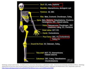 Radiology assitant. Bone tumor - A-G Bone tumors and tumor-like lesions in alphabethic order . Henk Jan van de Woude and Robin Smithuis . Radiology
condroma
department of the Onze Lieve Vrouwe Gasthuis, Amsterdam and the Rijnland hospital, Leiderdorp, the Netherlands. 2011. Disponible a partir de:
http://www.radiologyassistant.nl/en/p4bc9b15f76a78/bone-tumor-a-g.html#i4bcaa2aed7898

 