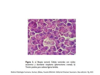 Robins Patología humana. Kumar, Abbas, Fausto Mitchel. Editorial Elseiver Saunsers. 8va edicion. Pg. 815

 