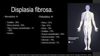 Displasia fibrosa.
• Monostótica 
 Costillas – 28%.
 Fémur proximal – 23%.
 Tibia y huesos craneofaciales – 10
– 25%.
 Húmero.
• Poliostótica 
 Fémur – 91%.
 Tibia – 81%.
 Pelvis – 78%.
 Costillas – 73%.
 Huesos craneofaciales – 50%.
 Columna lumbar – 14%.
 Clavícula – 10%.
 Columna cervical – 7%.
Fitzpatrick KA, Taljanovic MS, Speer DP et-al. Imaging findings of fibrous dysplasia with histopathologic and intraoperative correlation. AJR Am J Roentgenol. 2004;182 (6): 1389-98.
 