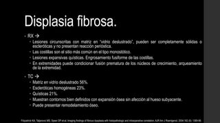 Displasia fibrosa.
• RX 
 Lesiones circunscritas con matriz en “vidrio deslustrado”, pueden ser completamente sólidas o
escleróticas y no presentan reacción perióstica.
 Las costillas son el sitio más común en el tipo monostótico.
 Lesiones expansivas quísticas. Engrosamiento fusiforme de las costillas.
 En extremidades puede condicionar fusión prematura de los núcleos de crecimiento, arqueamiento
de la extremidad.
• TC 
 Matriz en vidrio deslustrado 56%.
 Escleróticas homogéneas 23%.
 Quísticas 21%.
 Muestran contornos bien definidos con expansión ósea sin afección al hueso subyacente.
 Puede presentar remodelamiento óseo.
Fitzpatrick KA, Taljanovic MS, Speer DP et-al. Imaging findings of fibrous dysplasia with histopathologic and intraoperative correlation. AJR Am J Roentgenol. 2004;182 (6): 1389-98.
 
