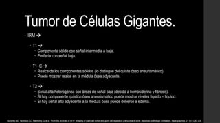 Tumor de Células Gigantes.
• IRM 
 T1 
 Componente sólido con señal intermedia a baja.
 Periferia con señal baja.
 T1+C 
 Realce de los componentes sólidos (lo distingue del quiste óseo aneurismático).
 Puede mostrar realce en la médula ósea adyacente.
 T2 
 Señal alta heterogénea con áreas de señal baja (debido a hemosiderina y fibrosis).
 Si hay componente quístico óseo aneurismático puede mostrar niveles líquido – líquido.
 Si hay señal alta adyacente a la médula ósea puede deberse a edema.
Murphey MD, Nomikos GC, Flemming DJ et-al. From the archives of AFIP. Imaging of giant cell tumor and giant cell reparative granuloma of bone: radiologic-pathologic correlation. Radiographics. 21 (5): 1283-309.
 