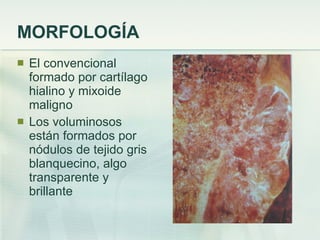 MORFOLOGÍA El convencional formado por cartílago hialino y mixoide maligno Los voluminosos están formados por nódulos de tejido gris blanquecino, algo transparente y brillante 