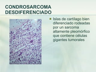 CONDROSARCOMA DESDIFERENCIADO Islas de cartílago bien diferenciado rodeadas por un sarcoma altamente pleomórfico que contiene células gigantes tumorales 