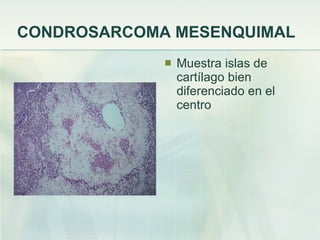 CONDROSARCOMA MESENQUIMAL Muestra islas de cartílago bien diferenciado en el centro 