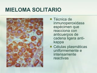MIELOMA SOLITARIO Técnica de inmunoperoxidasa espécimen que reacciona con anticuerpos de cadena ligera anti-kappa  Células plasmáticas uniformemente e intensamente reactivas 