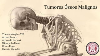 Tumores Óseos Malignos
Traumatología – 7°E
Arturo Franco
Armando Hervert
Midory Arellano
Ulises Reyes
Ramsés Abundiz
 