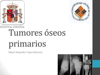 Tumores óseos
primarios
Mijail Alejandro Tapia Moreno

 