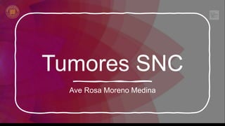 Tumores SNC
Ave Rosa Moreno Medina
 