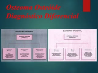 Osteoma Osteóide
Diagnóstico Diferencial
 