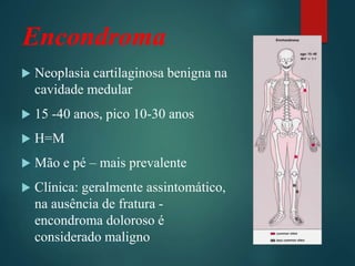 Encondroma
 Neoplasia cartilaginosa benigna na
cavidade medular
 15 -40 anos, pico 10-30 anos
 H=M
 Mão e pé – mais prevalente
 Clínica: geralmente assintomático,
na ausência de fratura -
encondroma doloroso é
considerado maligno
 